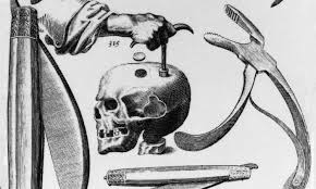 Seems a bit Screwy, this act of 'TREPHINATION' During this period, if something was wrong with a person's head, they just drilled a hole and let out the 'BAD'.